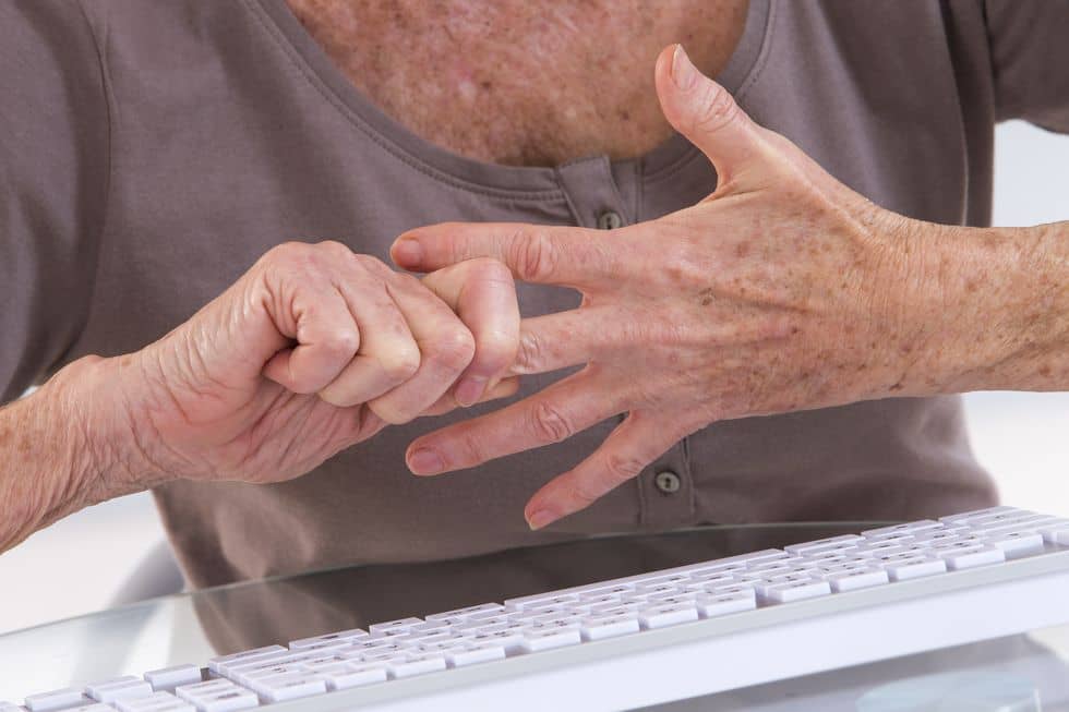 Arthritis hands 