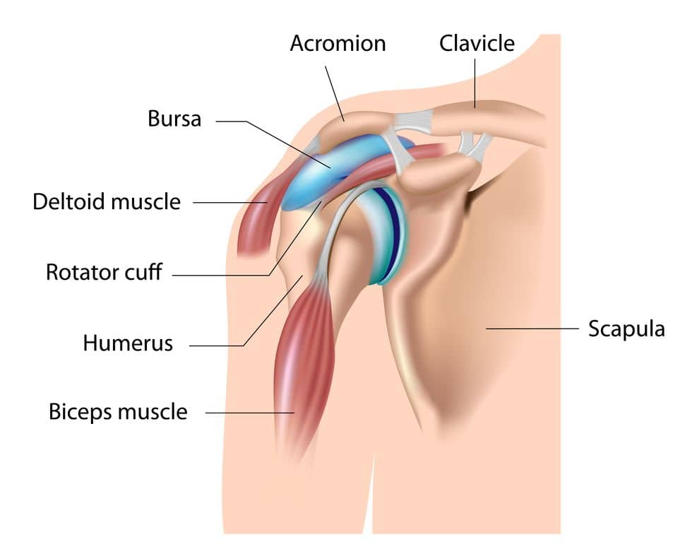 Bursitis